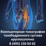 Компьютерная томография тазобедренного сустава – сделать КТ круглосуточно