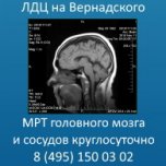 МРТ головного мозга и сосудов цена в Москве