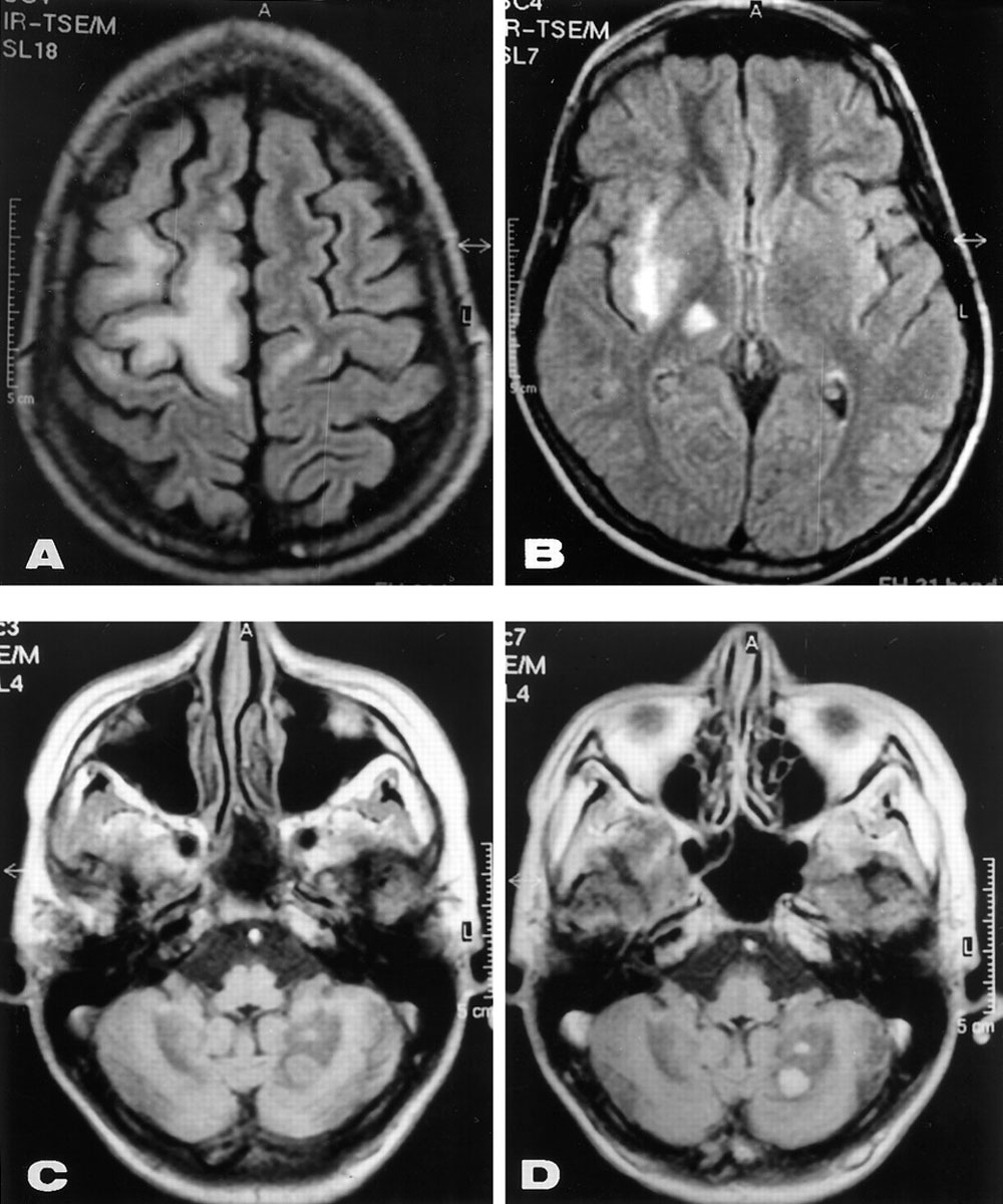 Мрт головного мозга в центре. Магниторезонансная томография головного мозга. Компьютерная томография головного мозга норма. Снимок мрт головного мозга здорового человека. Мрт головного мозга Axial норма.