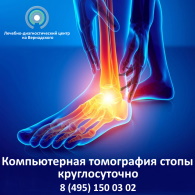 Компьютерная томография стопы – сделать КТ со скидкой в Москве