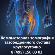 Компьютерная томография тазобедренного сустава – сделать КТ круглосуточно