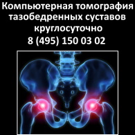 Компьютерная томография тазобедренных суставов