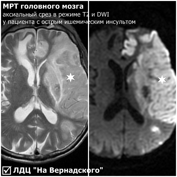 Мрт мозга ульяновске цены