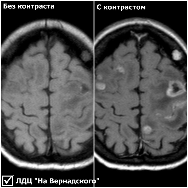 МРТ : сколько стоит платное МРТ, цены